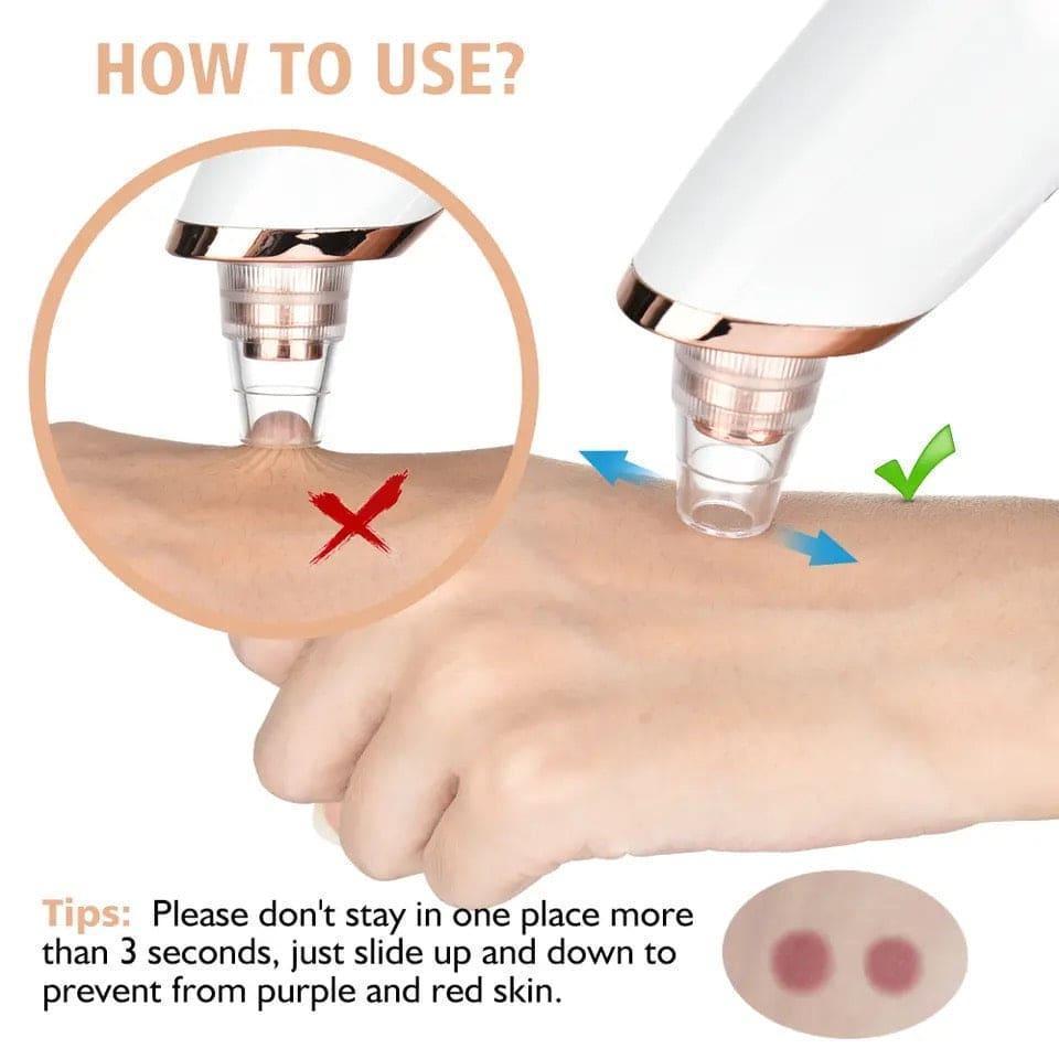 Original 5 in 1 Multi-functional Black Head Removal Derma Suction Machine Blackhead Remover